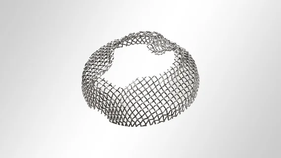 Pièce moulée en toile métallique emboutie ronde avec évidement